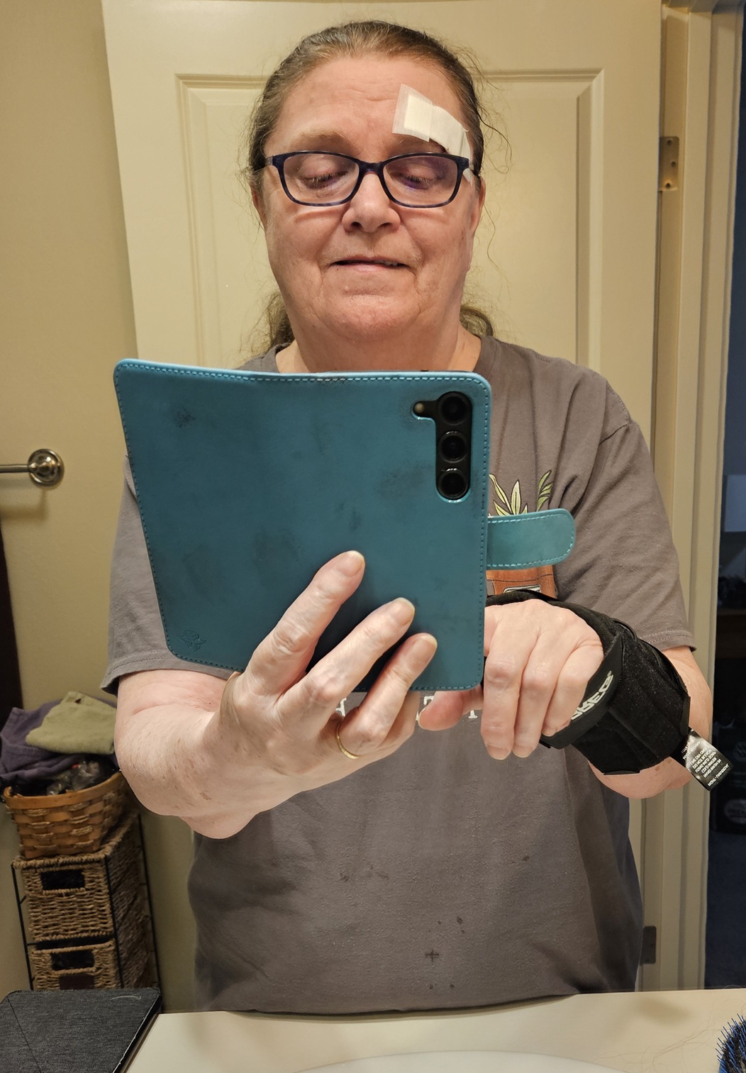 the author taking a picture of herself in a mirror, with bandage over eye and splint on right hand.